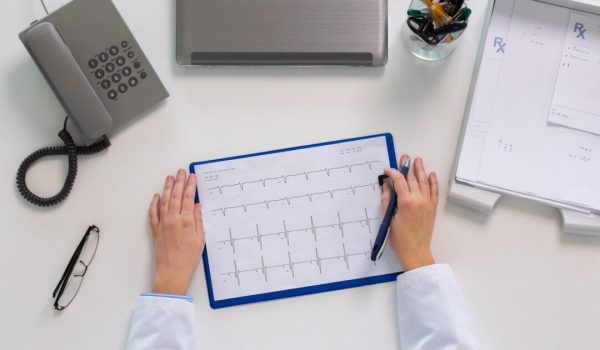doctor hands with cardiogram at table